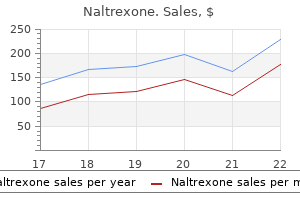 purchase naltrexone no prescription