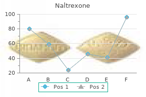 purchase naltrexone 50 mg overnight delivery