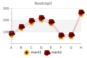 order nootropil us