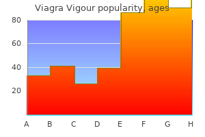 order 800 mg viagra vigour free shipping
