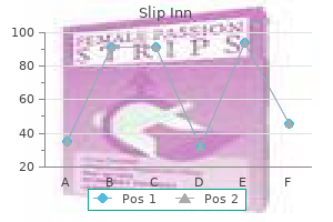 best order slip inn